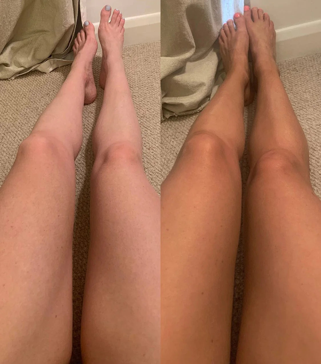 BEETTAN Self-Tanning Lotion